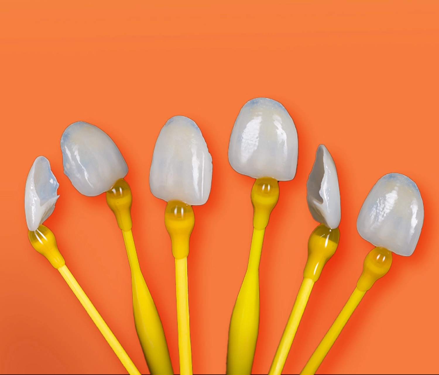 Dán răng sứ Veneer ở đâu tốt? Nên dán loại nào?